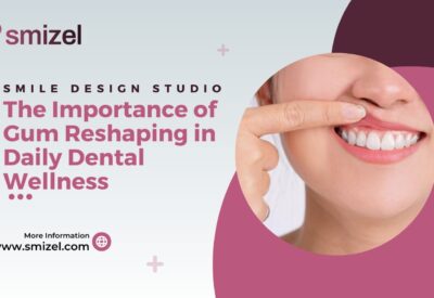 Bridal Dental Makeup in Ludhiana, Bridal Dental Studio Ludhiana, Wedding Smile Makeover Ludhiana, Bridal Dental Care Ludhiana, Cosmetic Dentistry for Brides in Ludhiana, Ludhiana Bridal Smile Enhancement, Pre-Wedding Dental Services Ludhiana, Bridal Teeth Whitening Ludhiana, Tooth Jewelry Ludhiana, Bridal Dental Accessories in Ludhiana
