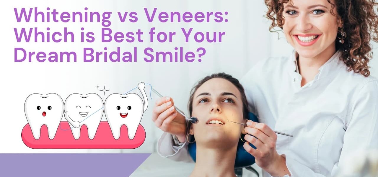 Bridal Dental Makeup in Ludhiana, Bridal Dental Studio Ludhiana, Wedding Smile Makeover Ludhiana, Bridal Dental Care Ludhiana, Cosmetic Dentistry for Brides in Ludhiana, Ludhiana Bridal Smile Enhancement, Pre-Wedding Dental Services Ludhiana, Bridal Teeth Whitening Ludhiana, Tooth Jewelry Ludhiana, Bridal Dental Accessories in Ludhiana