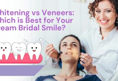 Bridal Dental Makeup in Ludhiana, Bridal Dental Studio Ludhiana, Wedding Smile Makeover Ludhiana, Bridal Dental Care Ludhiana, Cosmetic Dentistry for Brides in Ludhiana, Ludhiana Bridal Smile Enhancement, Pre-Wedding Dental Services Ludhiana, Bridal Teeth Whitening Ludhiana, Tooth Jewelry Ludhiana, Bridal Dental Accessories in Ludhiana