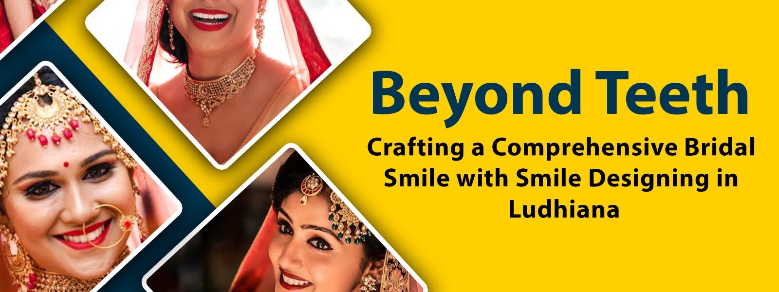 Bridal Dental Makeup in Ludhiana, Bridal Dental Studio Ludhiana, Wedding Smile Makeover Ludhiana, Bridal Dental Care Ludhiana, Cosmetic Dentistry for Brides in Ludhiana, Ludhiana Bridal Smile Enhancement, Pre-Wedding Dental Services Ludhiana, Bridal Teeth Whitening Ludhiana, Tooth Jewelry Ludhiana, Bridal Dental Accessories in Ludhiana, Smile Design Ludhiana, Smile Designing Ludhiana