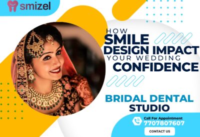 Bridal Dental Makeup in Ludhiana, Bridal Dental Studio Ludhiana, Wedding Smile Makeover Ludhiana, Bridal Dental Care Ludhiana, Cosmetic Dentistry for Brides in Ludhiana, Ludhiana Bridal Smile Enhancement, Pre-Wedding Dental Services Ludhiana, Bridal Teeth Whitening Ludhiana, Tooth Jewelry Ludhiana, Bridal Dental Accessories in Ludhiana, Smile Design Ludhiana, Smile Designing Ludhiana