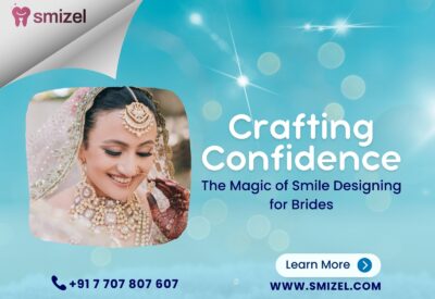 Bridal Dental Makeup in Ludhiana, Bridal Dental Studio Ludhiana, Wedding Smile Makeover Ludhiana, Bridal Dental Care Ludhiana, Cosmetic Dentistry for Brides in Ludhiana, Ludhiana Bridal Smile Enhancement, Pre-Wedding Dental Services Ludhiana, Bridal Teeth Whitening Ludhiana, Tooth Jewelry Ludhiana, Bridal Dental Accessories in Ludhiana, Smile Design Ludhiana, Smile Designing Ludhiana