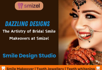 Bridal Dental Makeup in Ludhiana, Bridal Dental Studio Ludhiana, Wedding Smile Makeover Ludhiana, Bridal Dental Care Ludhiana, Cosmetic Dentistry for Brides in Ludhiana, Ludhiana Bridal Smile Enhancement, Pre-Wedding Dental Services Ludhiana, Bridal Teeth Whitening Ludhiana, Tooth Jewelry Ludhiana, Bridal Dental Accessories in Ludhiana, Smile Design Ludhiana, Smile Designing Ludhiana