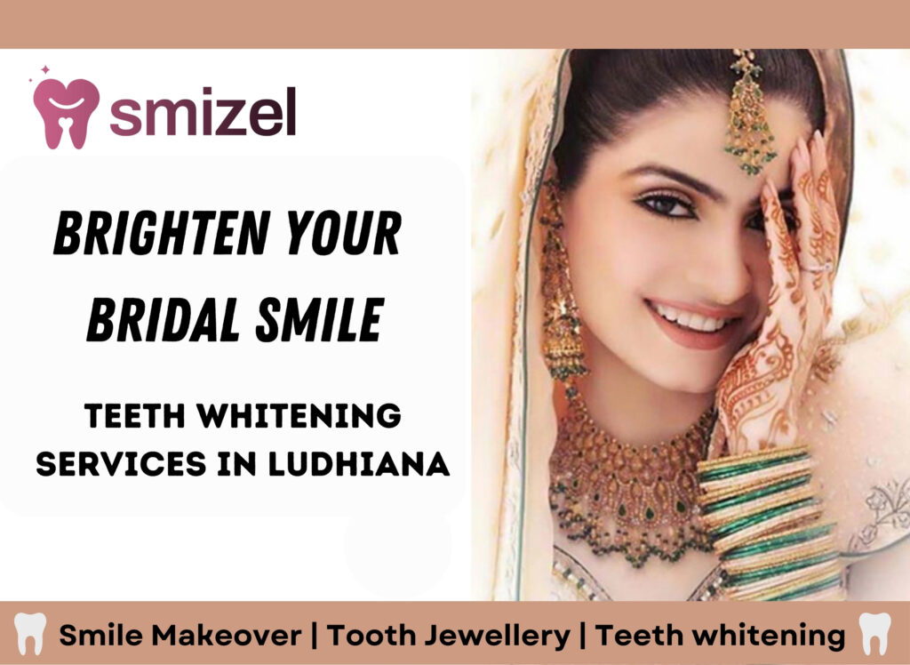 Bridal Dental Makeup in Ludhiana, Bridal Dental Studio Ludhiana, Wedding Smile Makeover Ludhiana, Bridal Dental Care Ludhiana, Cosmetic Dentistry for Brides in Ludhiana, Ludhiana Bridal Smile Enhancement, Pre-Wedding Dental Services Ludhiana, Bridal Teeth Whitening Ludhiana, Tooth Jewelry Ludhiana, Bridal Dental Accessories in Ludhiana